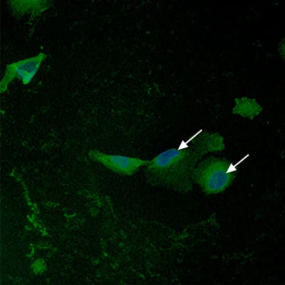 Control cell immunofluorescence