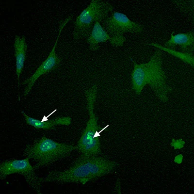 Sulforaphane and Maitake cell immunofluorescence