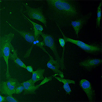 NQO1 Protein Expression in THLE2 Liver Cells