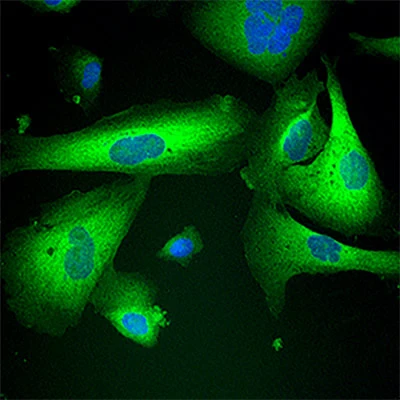 NQO1 Protein Expression in THLE2 Liver Cells