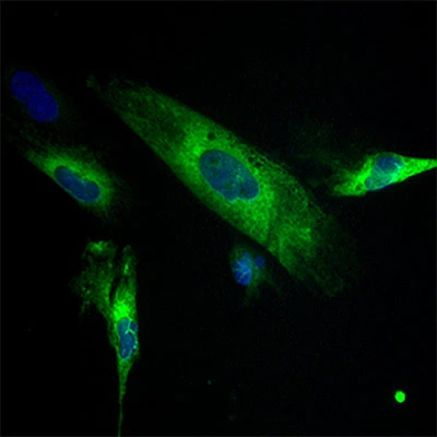 HO-1 Protein Expression in THLE2 Liver Cells